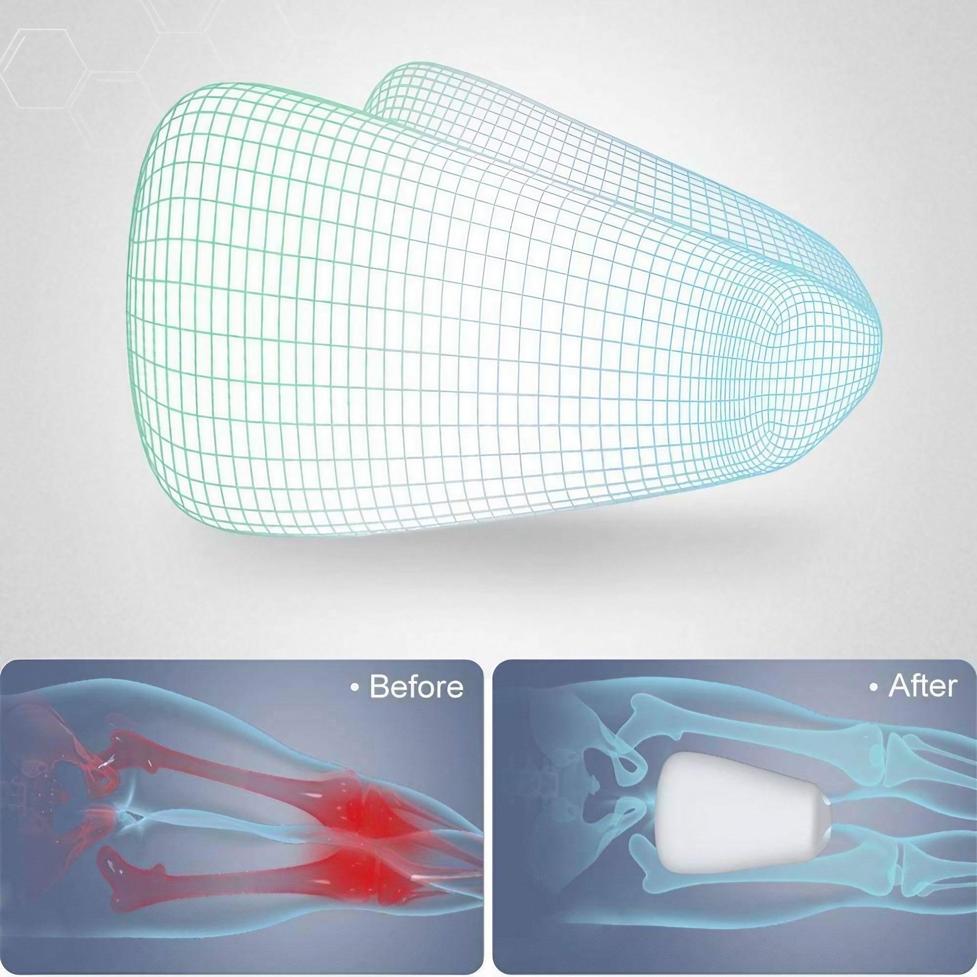Coussin Orthopédique : 1 Acheté = 1 Offert